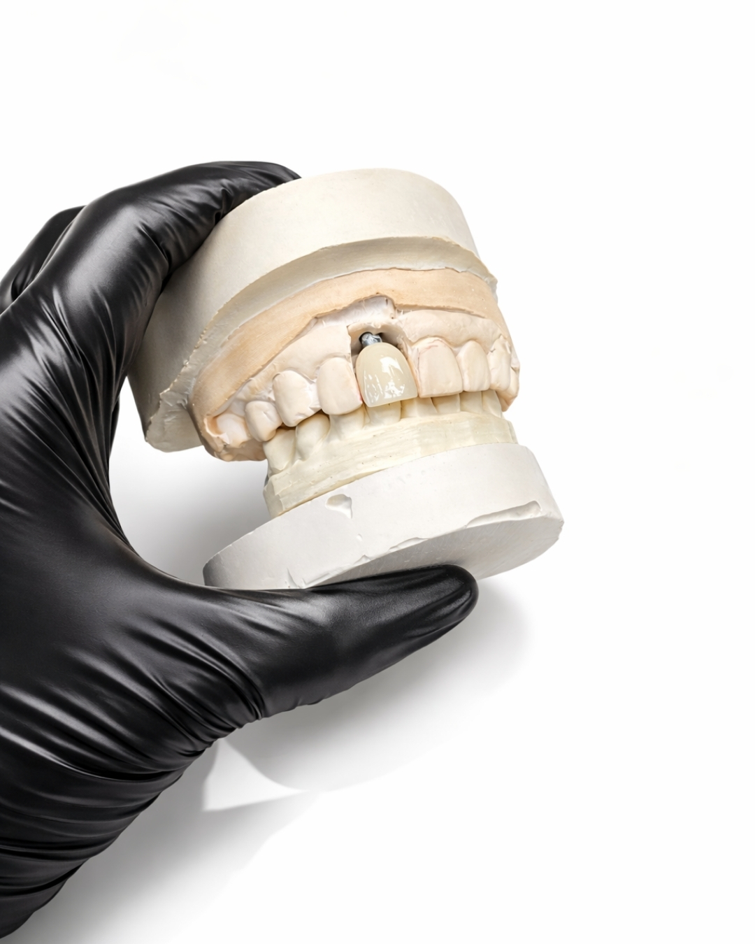 Advanced Implant  -  materials